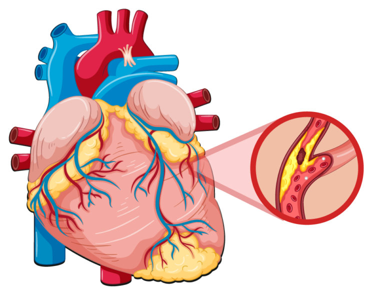 Six beneficial diets to keep you healthy and maintaining cholesterol